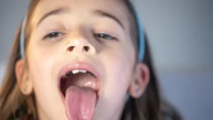 Lidah Bayi Terikat? Jangan Panik Dulu!