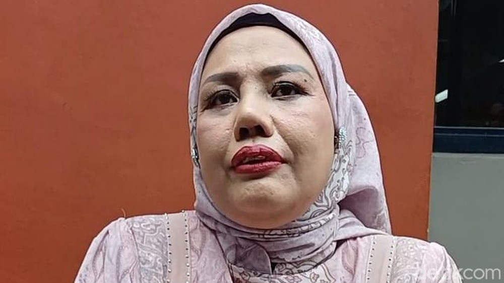 Elly Sugigi Pamer Wajah Baru Bikin Melongo