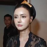 Wajah Nita Gunawan Berubah Usai Operasi